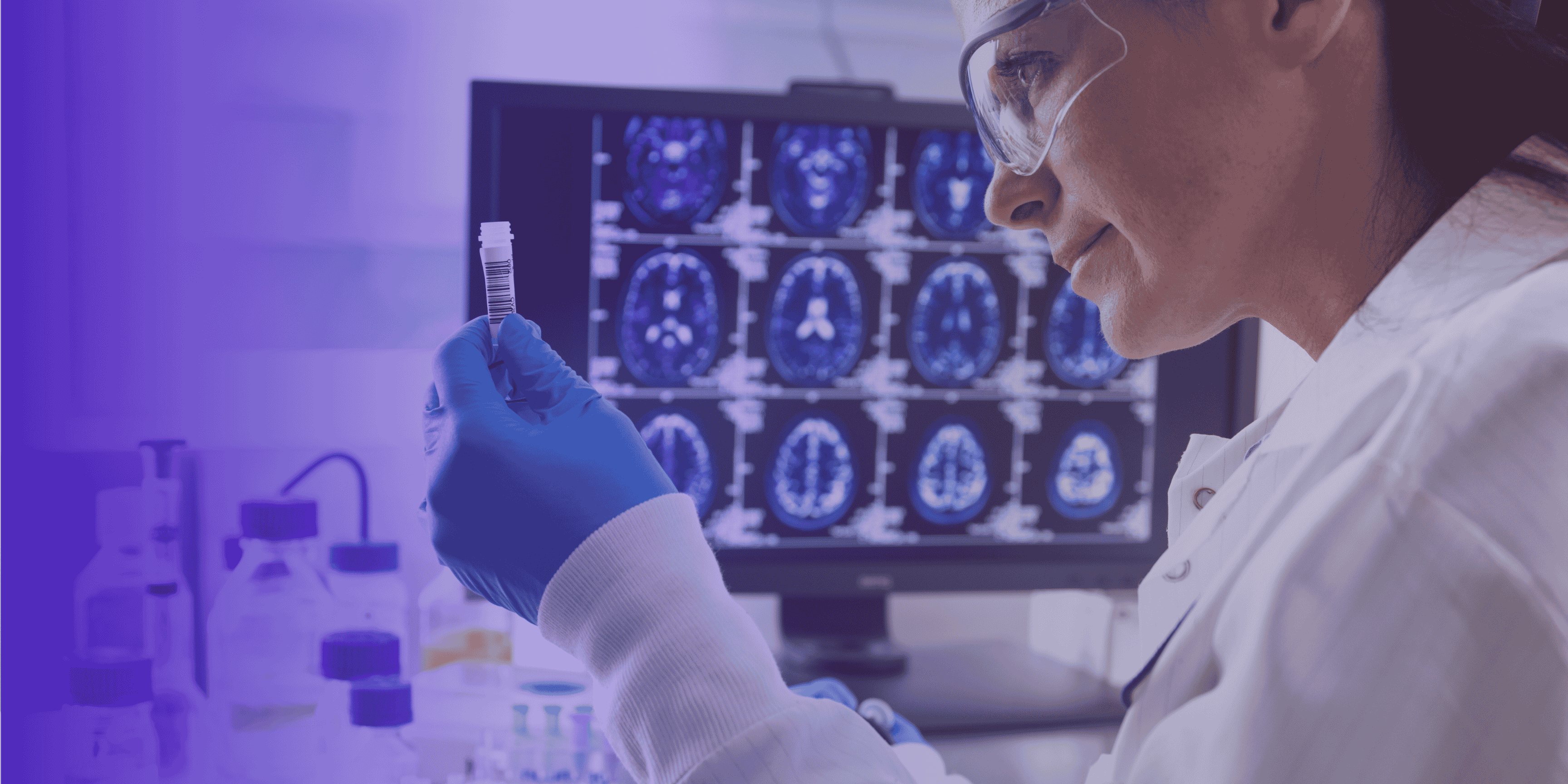 Scientifique analysant un échantillon devant un écran montrant des IRM cérébrales.